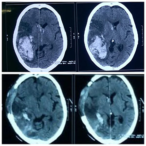 brain image