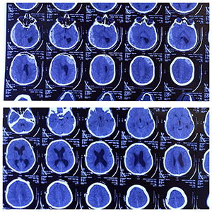 brain image