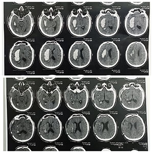 brain image