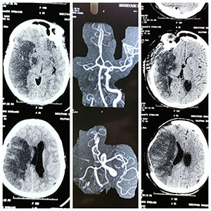 brain image