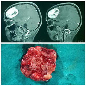 brain image