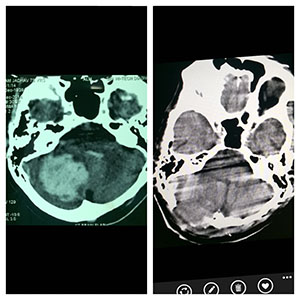 brain image