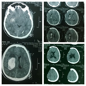 brain image