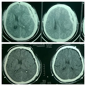 brain image