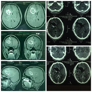brain image