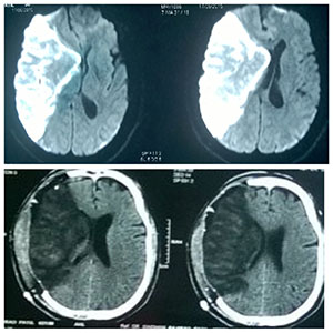 brain image