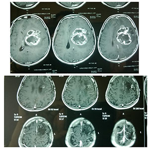 brain image