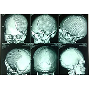 brain image