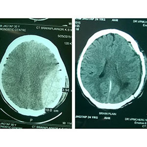 brain image